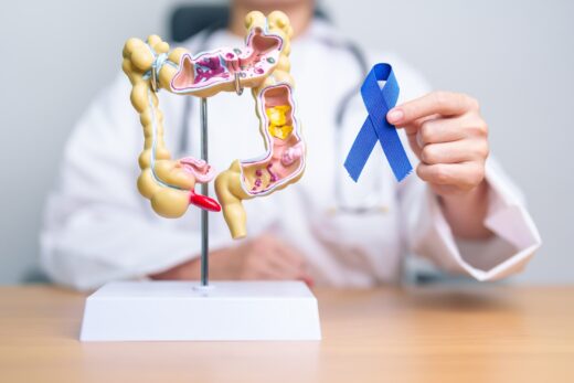 cancer-colorectal-toxine-intestinale-inquietan